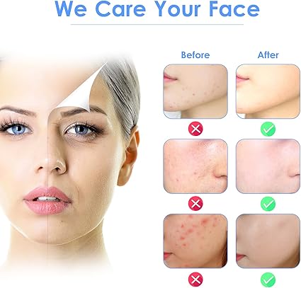 Pala de Limpieza Facial Ultrasónica Recargable